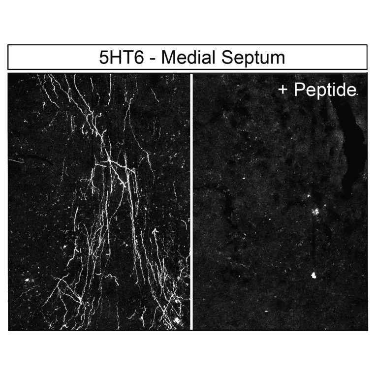 Immunohistochemistry - Anti-5HT6 Receptor Antibody (A334487) - Antibodies.com