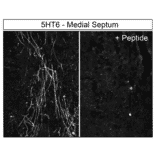 Immunohistochemistry - Anti-5HT6 Receptor Antibody (A334487) - Antibodies.com