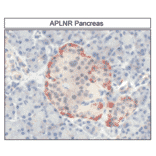 Immunohistochemistry - Anti-APJ Antibody (A334491) - Antibodies.com