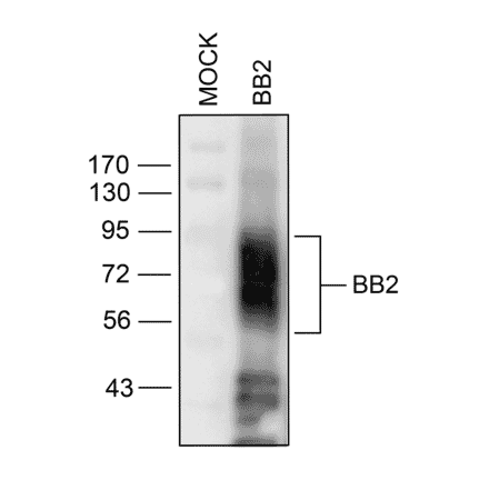 Western blot - Anti-GRPR Antibody (A334492) - Antibodies.com