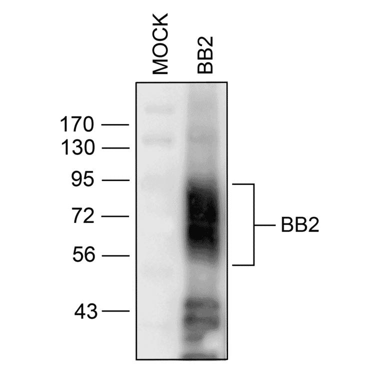 Western blot - Anti-GRPR Antibody (A334492) - Antibodies.com