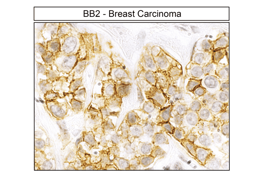 Immunohistochemistry - Anti-GRPR Antibody (A334492) - Antibodies.com
