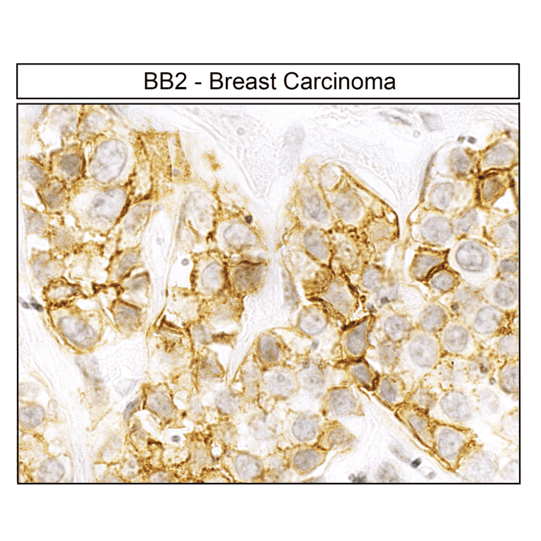 Immunohistochemistry - Anti-GRPR Antibody (A334492) - Antibodies.com