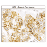 Immunohistochemistry - Anti-GRPR Antibody (A334492) - Antibodies.com