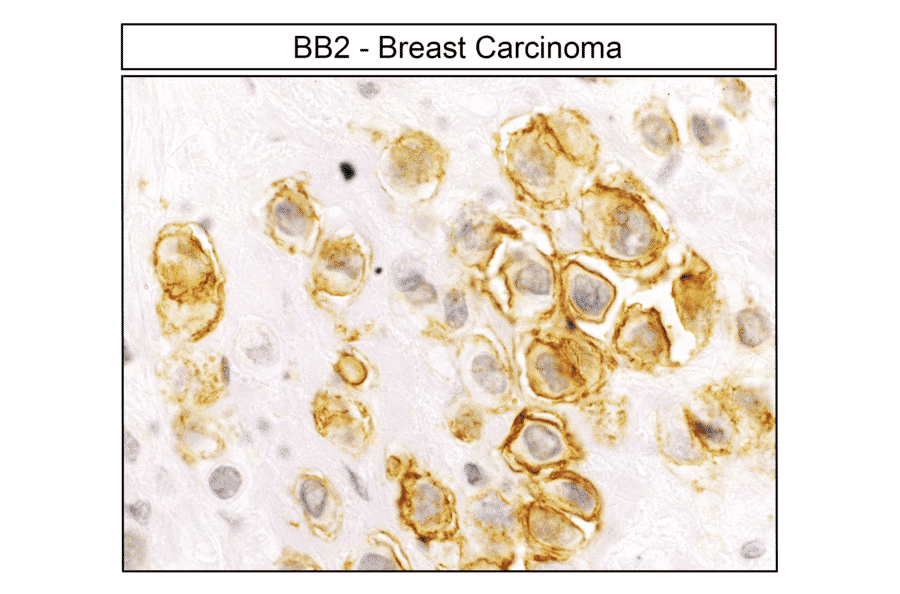 Immunohistochemistry - Anti-GRPR Antibody (A334492) - Antibodies.com