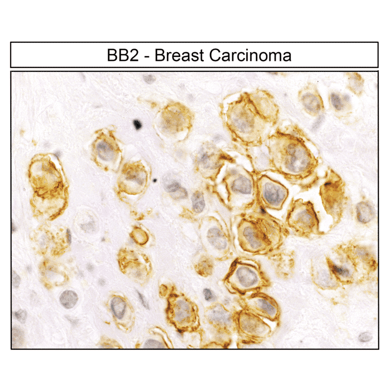 Immunohistochemistry - Anti-GRPR Antibody (A334492) - Antibodies.com
