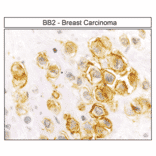 Immunohistochemistry - Anti-GRPR Antibody (A334492) - Antibodies.com