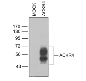 Immunohistochemistry - Anti-CCR11 Antibody (A334495) - Antibodies.com