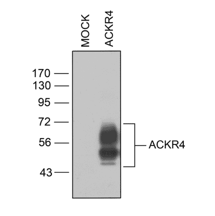 Immunohistochemistry - Anti-CCR11 Antibody (A334495) - Antibodies.com