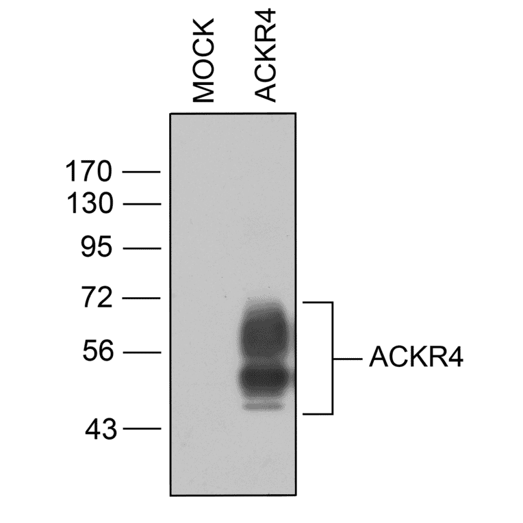 Immunohistochemistry - Anti-CCR11 Antibody (A334495) - Antibodies.com