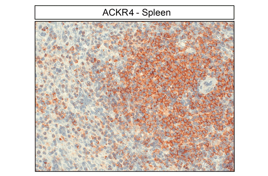 Immunohistochemistry - Anti-CCR11 Antibody (A334495) - Antibodies.com