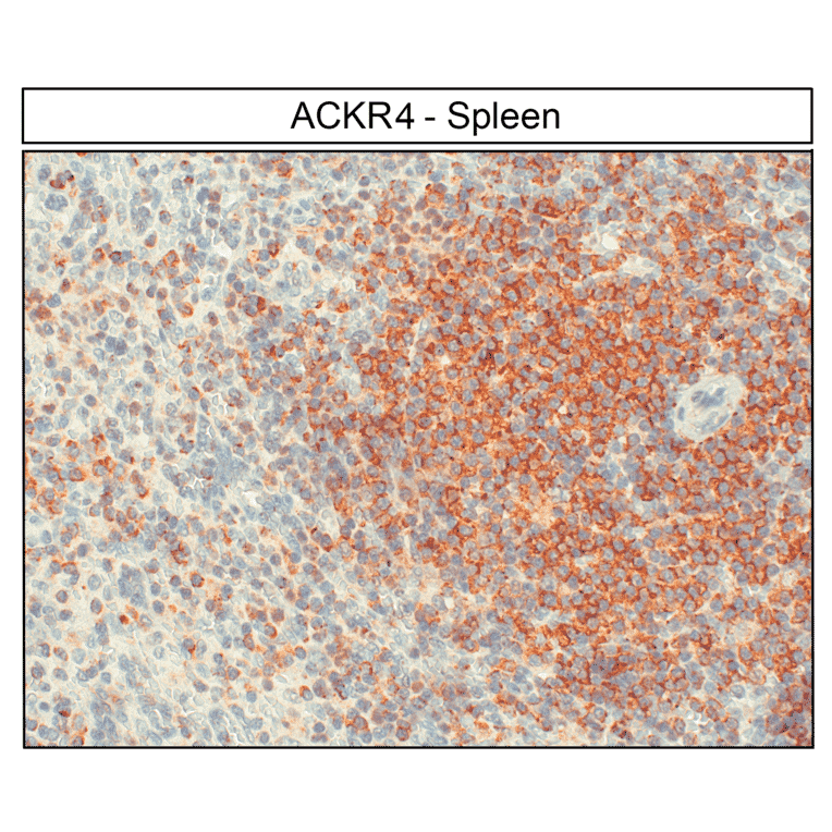 Immunohistochemistry - Anti-CCR11 Antibody (A334495) - Antibodies.com