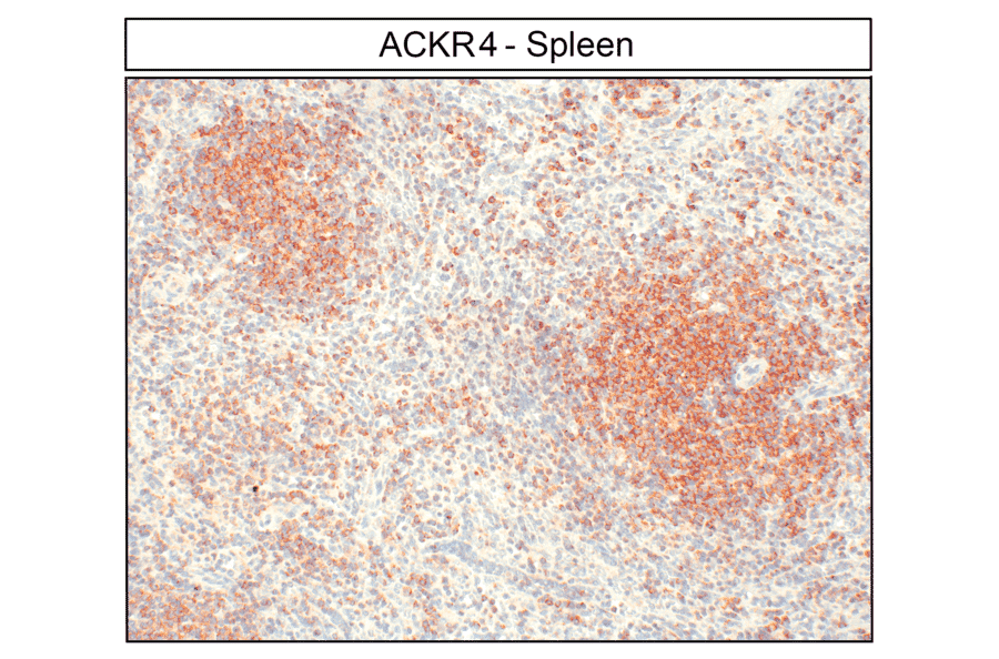 Immunohistochemistry - Anti-CCR11 Antibody (A334495) - Antibodies.com