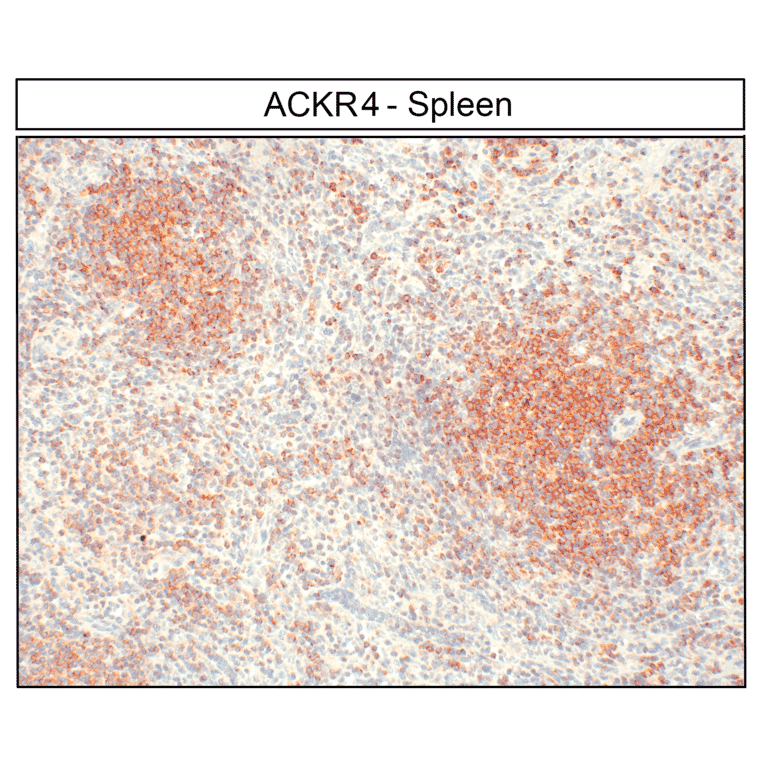 Immunohistochemistry - Anti-CCR11 Antibody (A334495) - Antibodies.com