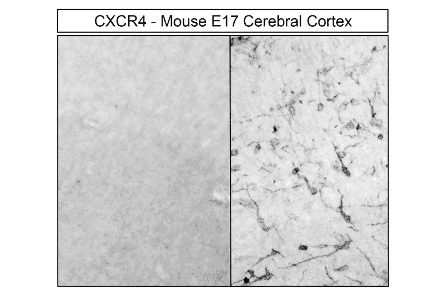 Immunohistochemistry - Anti-CXCR4 Antibody (A334501) - Antibodies.com