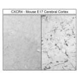 Immunohistochemistry - Anti-CXCR4 Antibody (A334501) - Antibodies.com