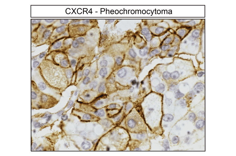 Immunohistochemistry - Anti-CXCR4 Antibody (A334501) - Antibodies.com