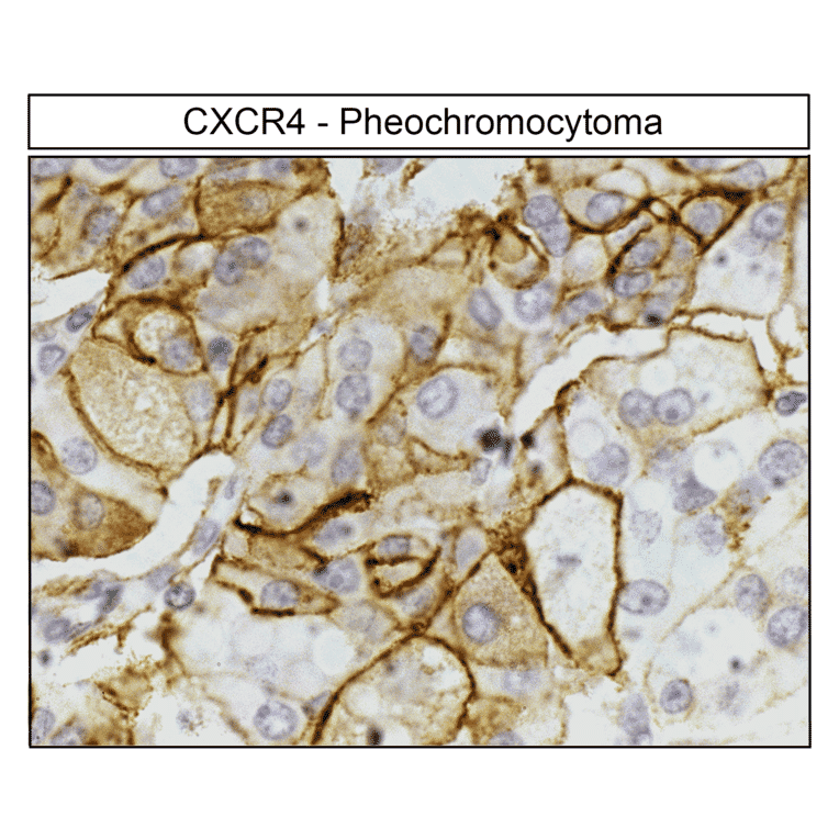 Immunohistochemistry - Anti-CXCR4 Antibody (A334501) - Antibodies.com