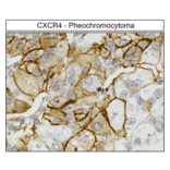 Immunohistochemistry - Anti-CXCR4 Antibody (A334501) - Antibodies.com