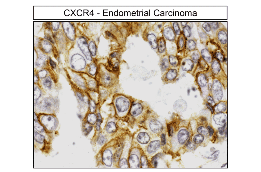 Immunohistochemistry - Anti-CXCR4 Antibody (A334501) - Antibodies.com