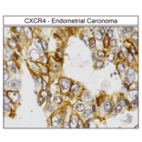 Immunohistochemistry - Anti-CXCR4 Antibody (A334501) - Antibodies.com