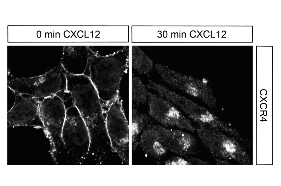 Immunohistochemistry - Anti-CXCR4 Antibody (A334501) - Antibodies.com