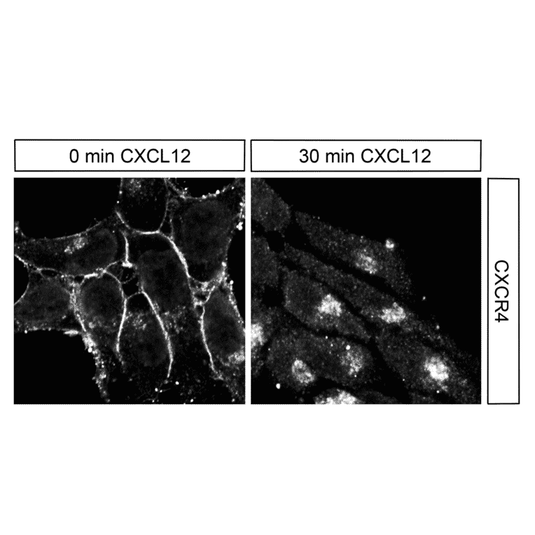 Immunohistochemistry - Anti-CXCR4 Antibody (A334501) - Antibodies.com
