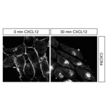 Immunohistochemistry - Anti-CXCR4 Antibody (A334501) - Antibodies.com
