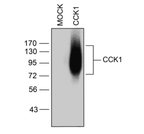 Western blot - Anti-CCKAR Antibody (A334502) - Antibodies.com