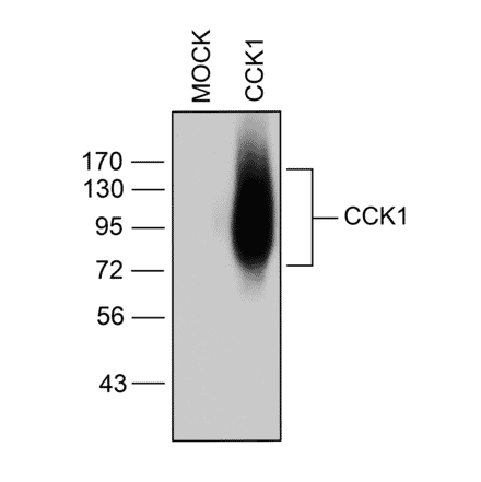 Western blot - Anti-CCKAR Antibody (A334502) - Antibodies.com