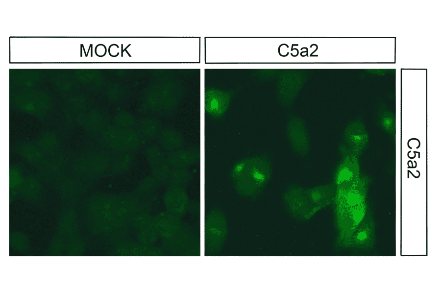 Immunohistochemistry - Anti-GPCR C5L2 Antibody (A334504) - Antibodies.com