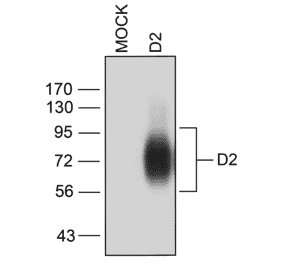 Western blot - Anti-DRD2 Antibody (A334505) - Antibodies.com