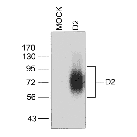 Western blot - Anti-DRD2 Antibody (A334505) - Antibodies.com