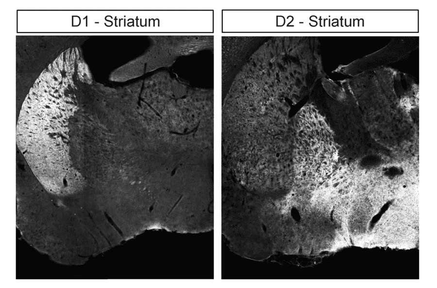 Immunohistochemistry - Anti-DRD2 Antibody (A334505) - Antibodies.com