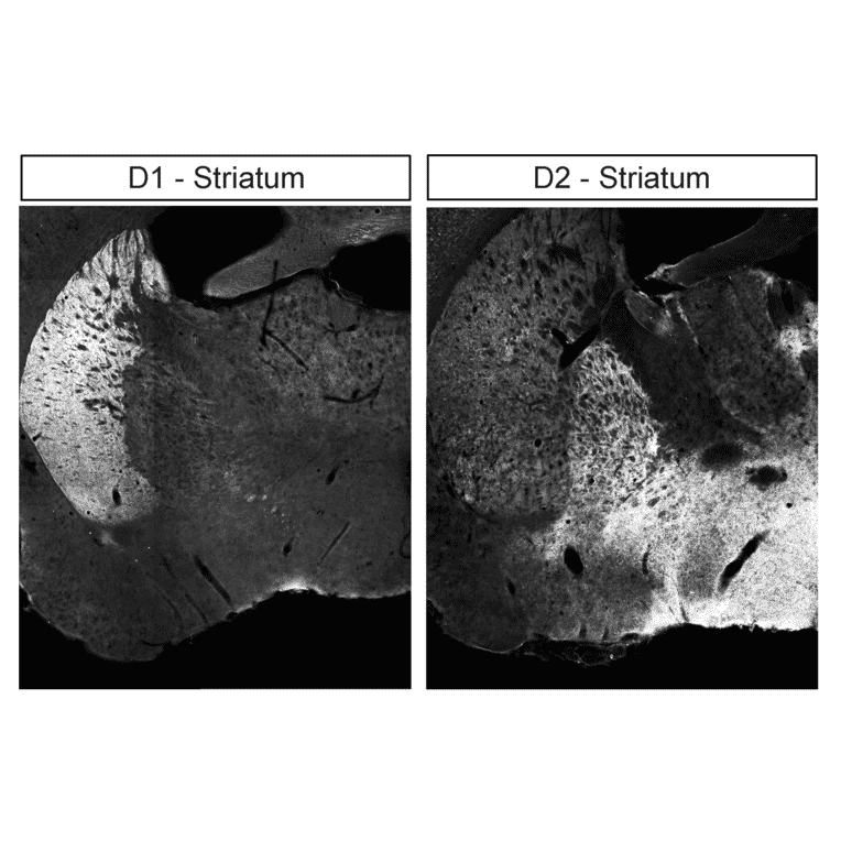 Immunohistochemistry - Anti-DRD2 Antibody (A334505) - Antibodies.com