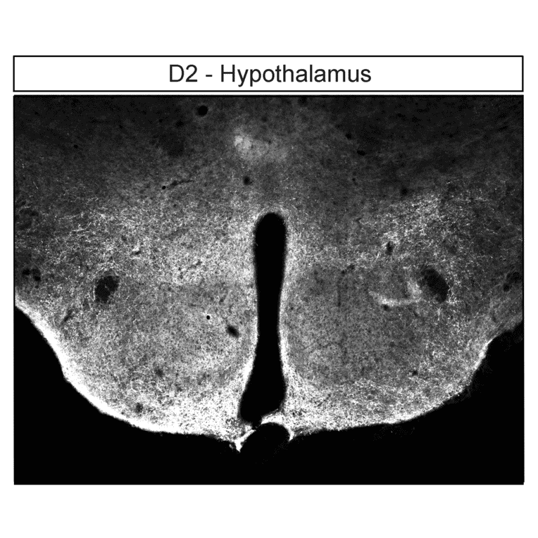 Immunohistochemistry - Anti-DRD2 Antibody (A334505) - Antibodies.com