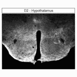 Immunohistochemistry - Anti-DRD2 Antibody (A334505) - Antibodies.com
