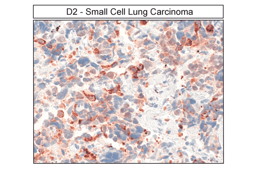 Immunohistochemistry - Anti-DRD2 Antibody (A334505) - Antibodies.com