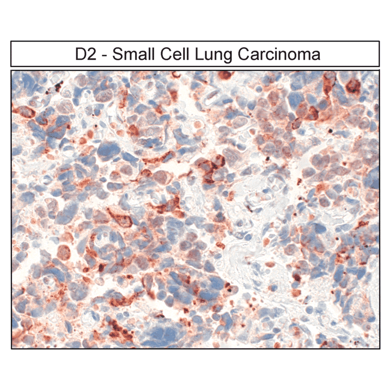 Immunohistochemistry - Anti-DRD2 Antibody (A334505) - Antibodies.com