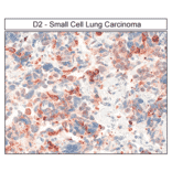 Immunohistochemistry - Anti-DRD2 Antibody (A334505) - Antibodies.com