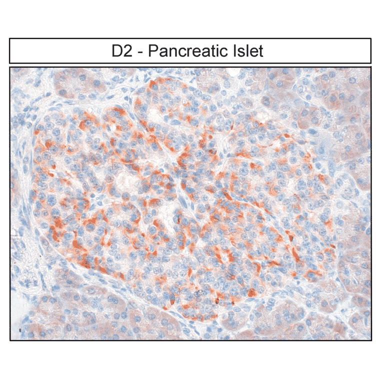 Immunohistochemistry - Anti-DRD2 Antibody (A334505) - Antibodies.com