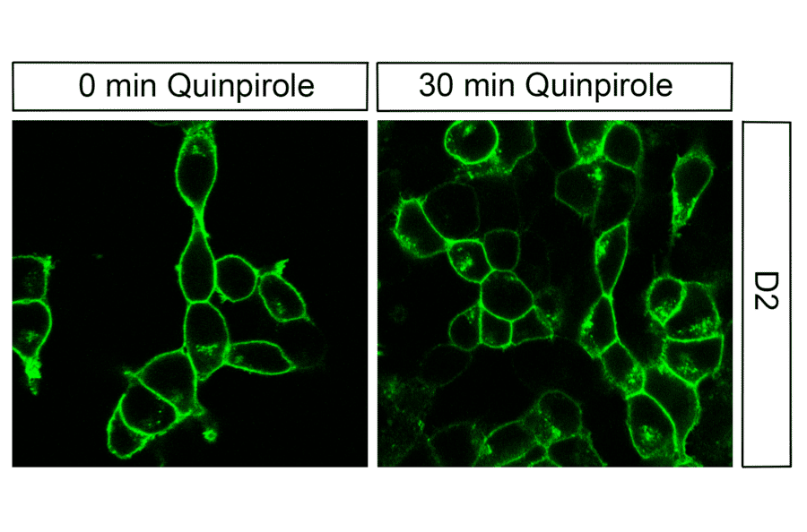 Immunohistochemistry - Anti-DRD2 Antibody (A334505) - Antibodies.com