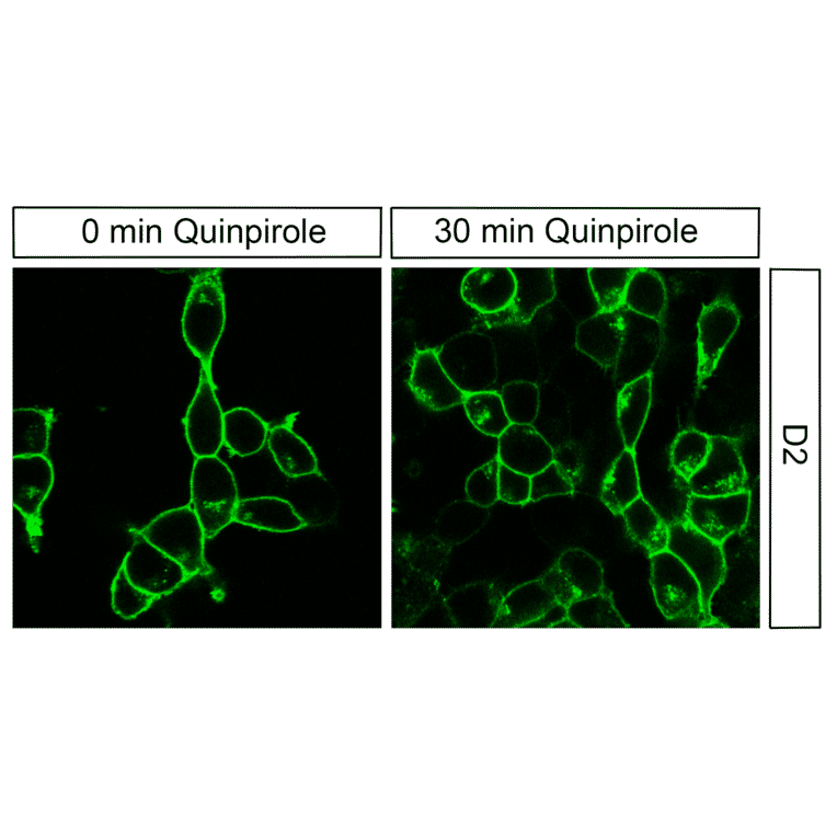 Immunohistochemistry - Anti-DRD2 Antibody (A334505) - Antibodies.com