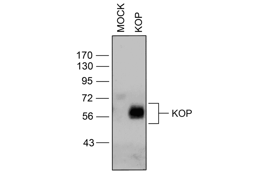 Western blot - Anti-Kappa Opioid Receptor Antibody (A334516) - Antibodies.com