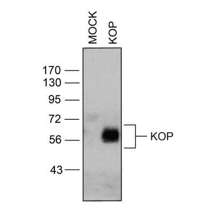Western blot - Anti-Kappa Opioid Receptor Antibody (A334516) - Antibodies.com