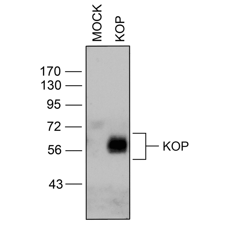 Western blot - Anti-Kappa Opioid Receptor Antibody (A334516) - Antibodies.com