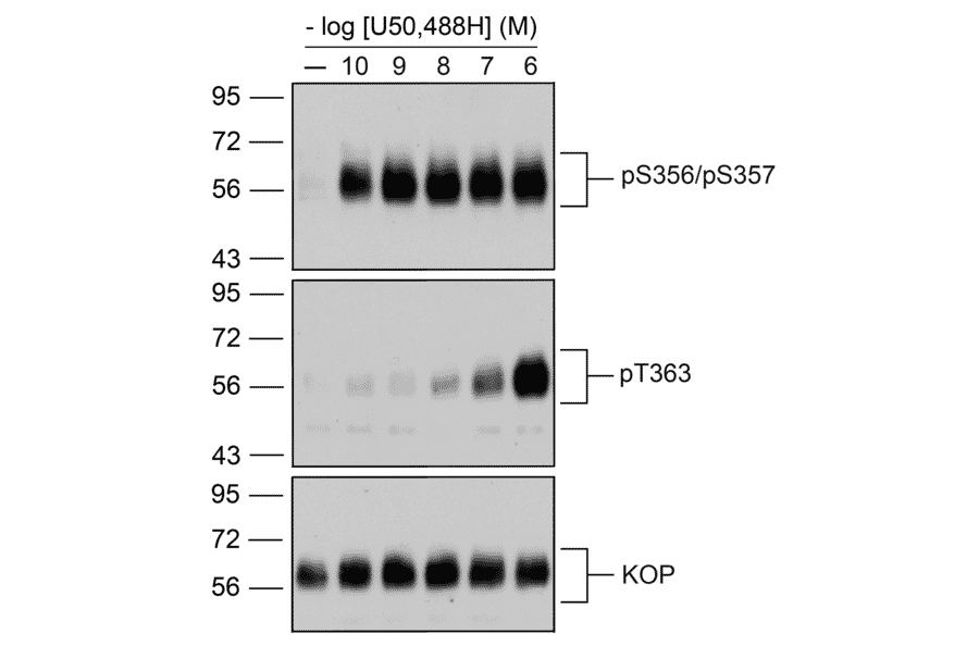 Western blot - Anti-Kappa Opioid Receptor Antibody (A334516) - Antibodies.com