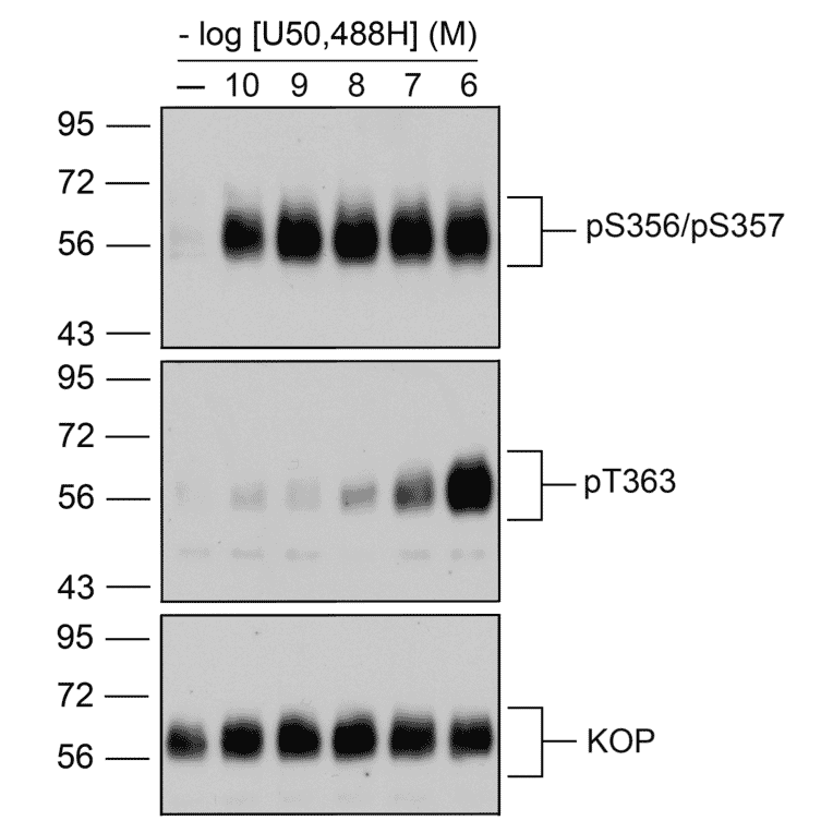 Western blot - Anti-Kappa Opioid Receptor Antibody (A334516) - Antibodies.com