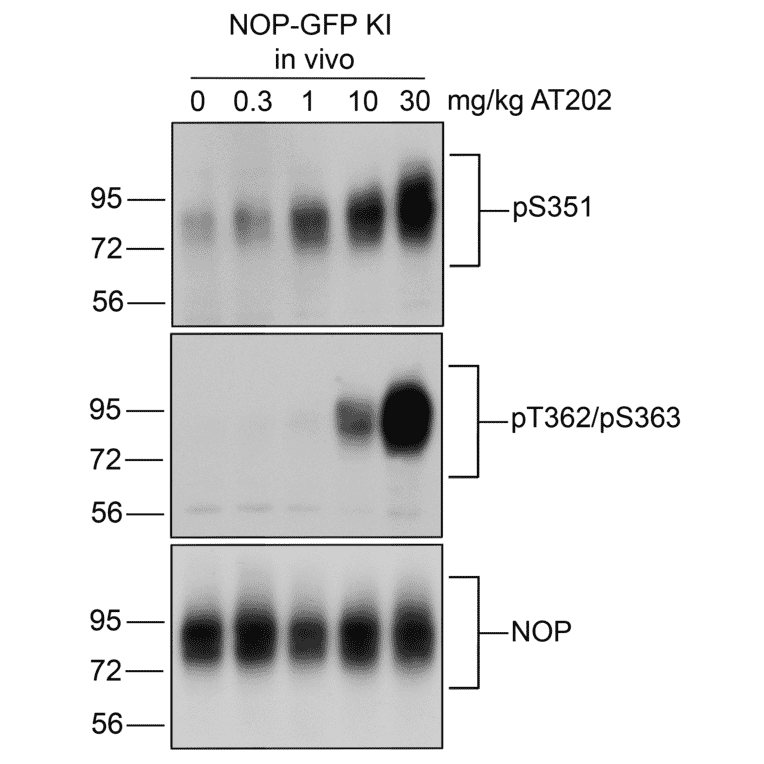 Western blot - Anti-Nociceptin Receptor Antibody (A334517) - Antibodies.com