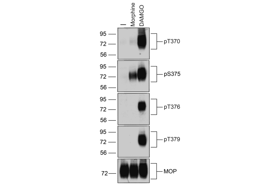 Western blot - Anti-Mu Opioid Receptor (phospho Ser375) Antibody (A334520) - Antibodies.com